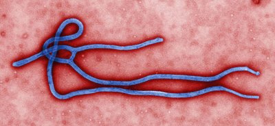 Ebola_virus_virion 630