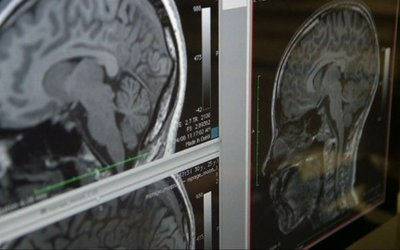 afternewtown_brains2_blog_main_horizontal