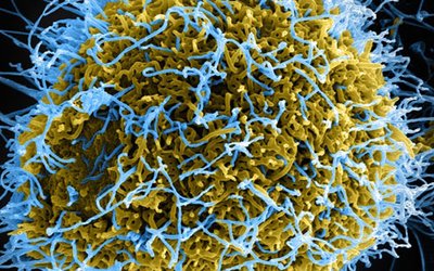 ebola virus that has multiplied 630