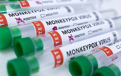 Illustration shows test tubes labelled "Monkeypox virus positive and negative\