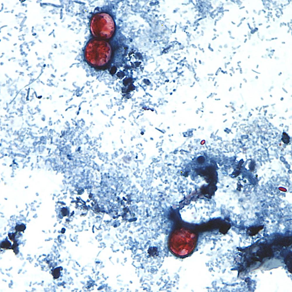 outbreak