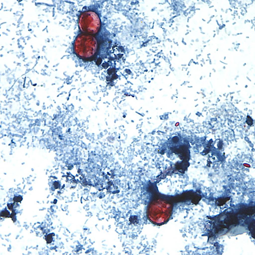 What we know about the cyclosporiasis outbreak linked to produce | PBS ...