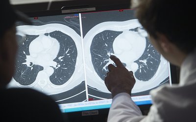 US-HEALTH-PEOPLE-RESEARCH-CANCER-pharmaceutical