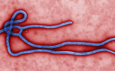 Ebola_virus_virion 630
