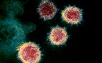 Transmission electron microscope image shows SARS-CoV-2, also known as novel coronavirus